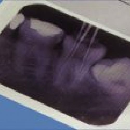 prodsec 155328