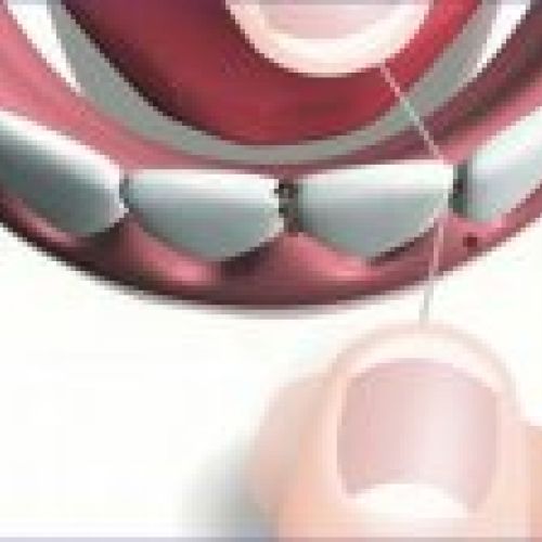 prodsec 156164