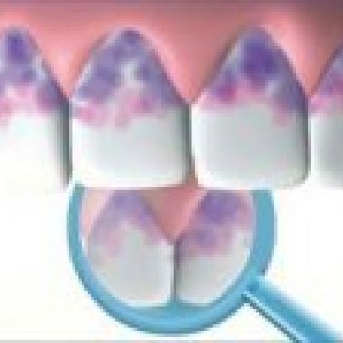 prodsec 156169