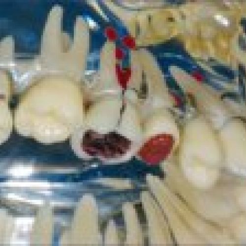 prodsec 155614