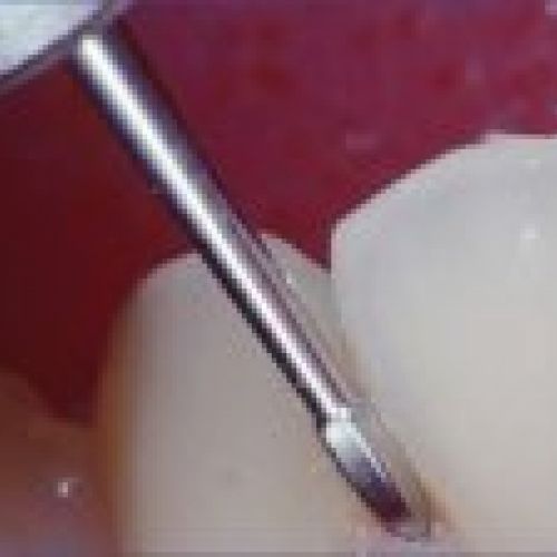 prodsec 155162